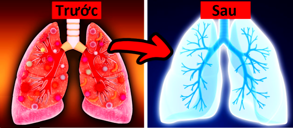 Bật mí các giải pháp giúp làm sạch phổi cho người hút thuốc lá