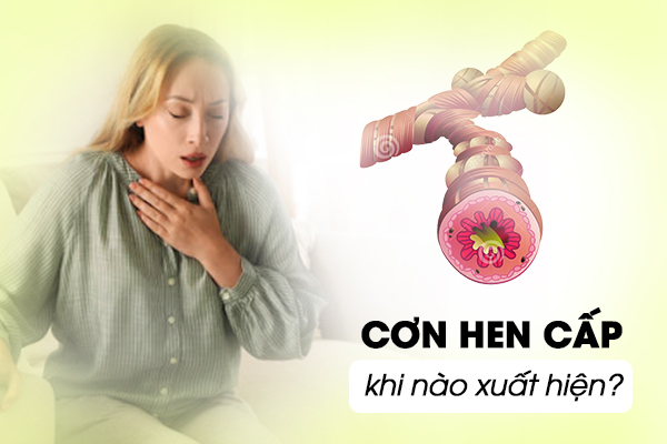 Cách xử trí cơn hen cấp tại nhà và giải pháp phòng ngừa hiệu quả