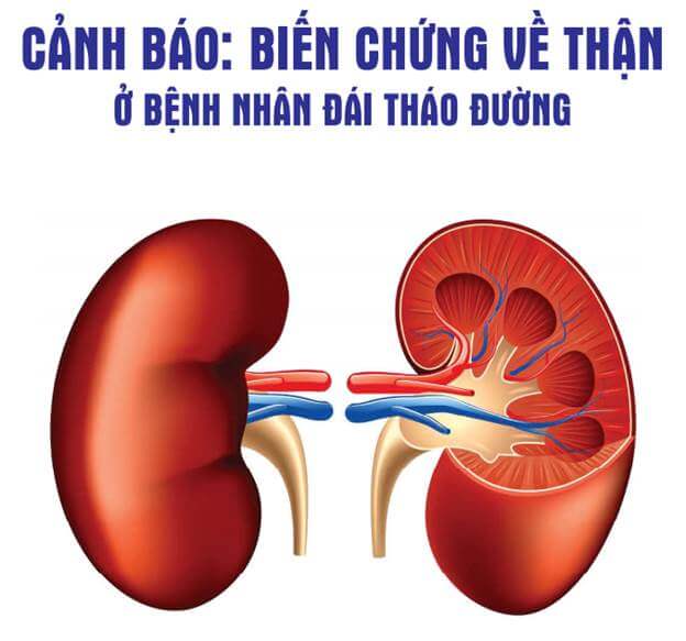 Biến chứng bệnh thận do đái tháo đường