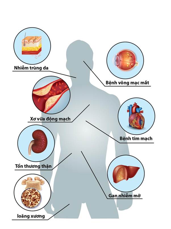 Các biến chứng có thể gặp khi đường huyết vượt cao quá mức