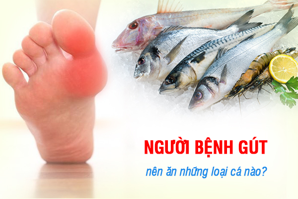 Người bệnh gút nên ăn những loại cá nào?