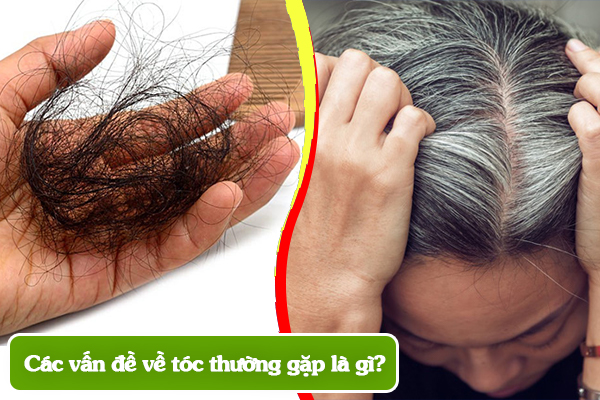 Các vấn đề về tóc thường gặp là gì?