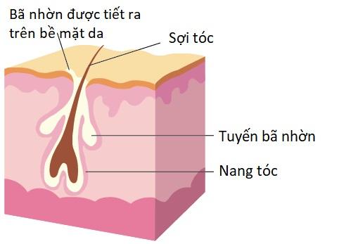 Tuyến bã nhờn ở tóc nhiều và hoạt động mạnh mẽ khiến tóc dễ gãy rụng