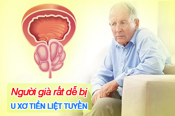 Người già rất dễ bị u xơ tiền liệt tuyến