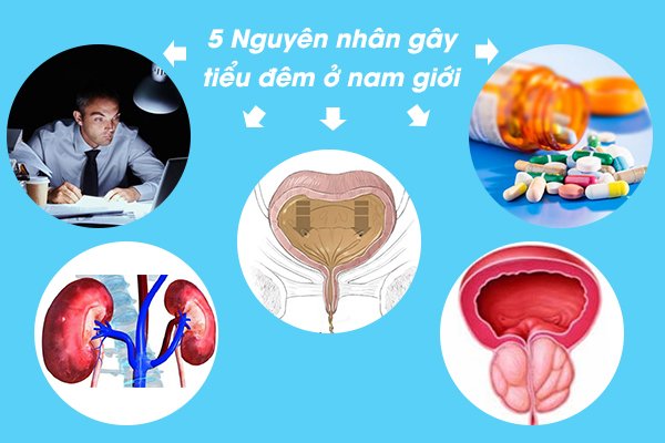 Nguyên nhân tiểu đêm ở nam giới là gì?