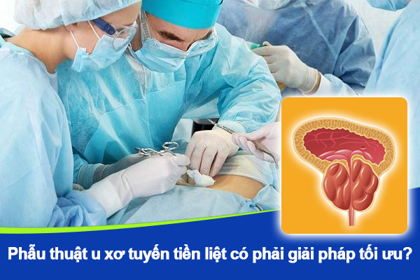 Phẫu thuật u xơ tuyến tiền liệt có phải giải pháp tối ưu?