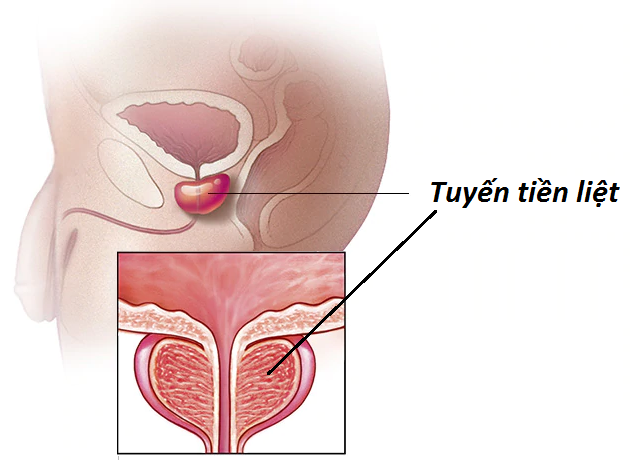 Tuyến tiền liệt là gì?