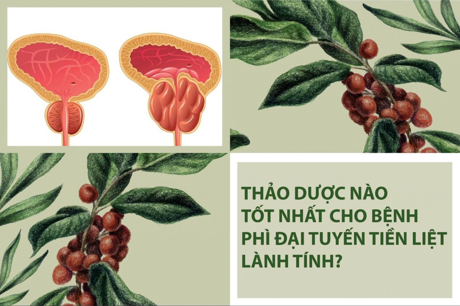 Loại thảo dược nào tốt nhất cho bệnh phì đại tuyến tiền liệt lành tính?