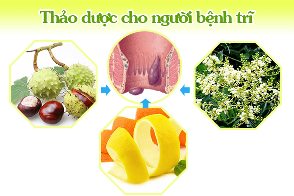 Những thảo dược tuyệt vời cho người bệnh trĩ