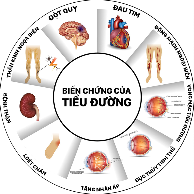 biến chứng bệnh tiểu đường