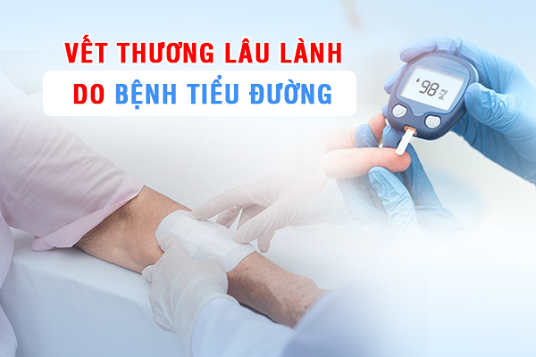 Vết thương lâu lành do bệnh tiểu đường.