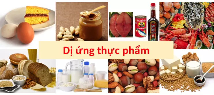 dị ứng thực phẩm thường gặp