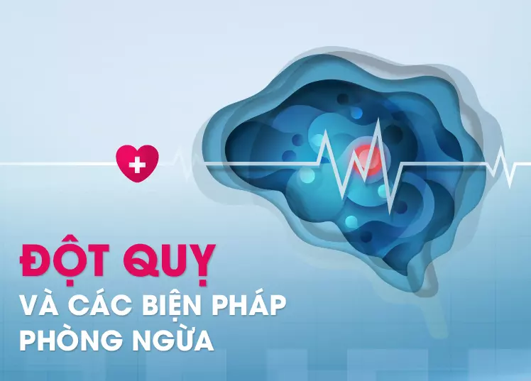 Phòng ngừa đột quỵ