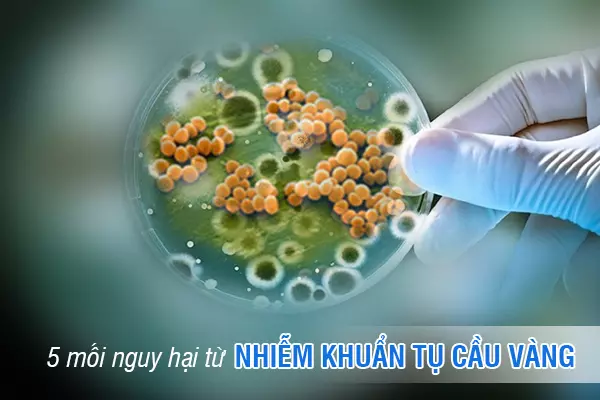 5 mối nguy hại từ nhiễm khuẩn tụ cầu vàng