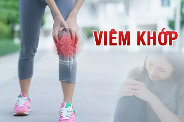 Viêm khớp - Căn bệnh không của riêng ai!