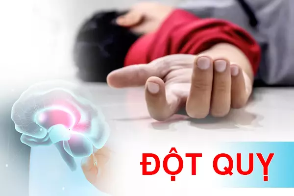 Thế nào là đột quỵ?