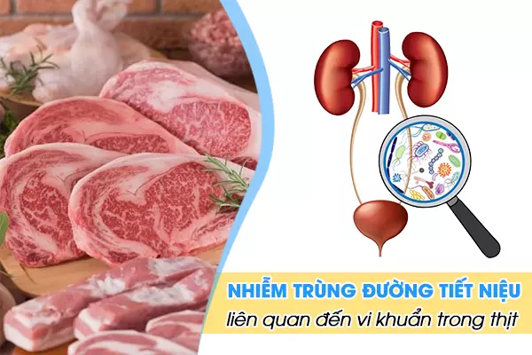  Xử lý thịt sống cẩn thận