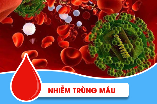 Nhiễm trùng máu