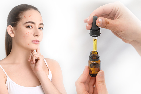 Serum nào giúp trị thâm mụn hiệu quả?