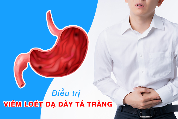 Cách điều trị viêm loét dạ dày tá tràng và những lưu ý cần biết