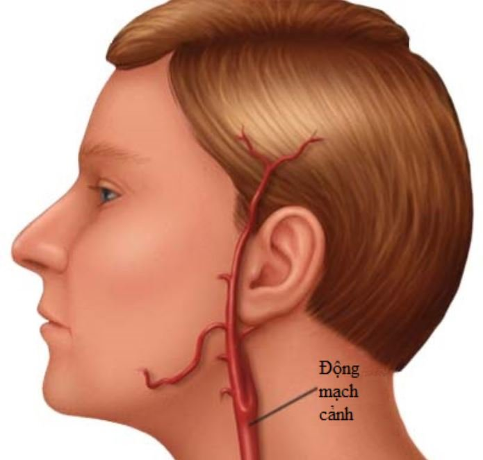 Hình ảnh của động mạch cảnh