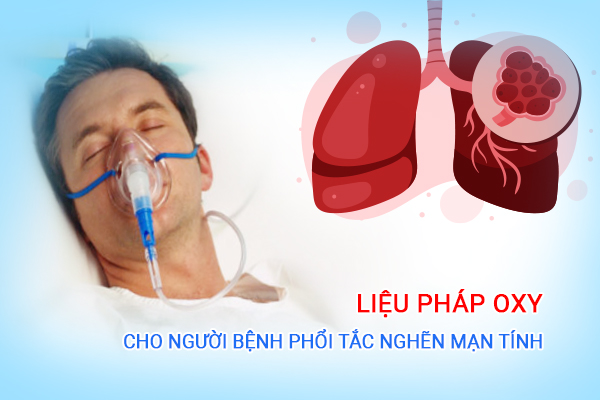 Tìm hiểu liệu pháp oxy cho người bệnh phổi tắc nghẽn mạn tính