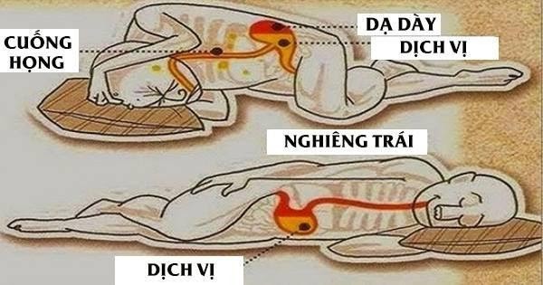 tư thế ngủ tốt cho bệnh trào ngược dạ dày