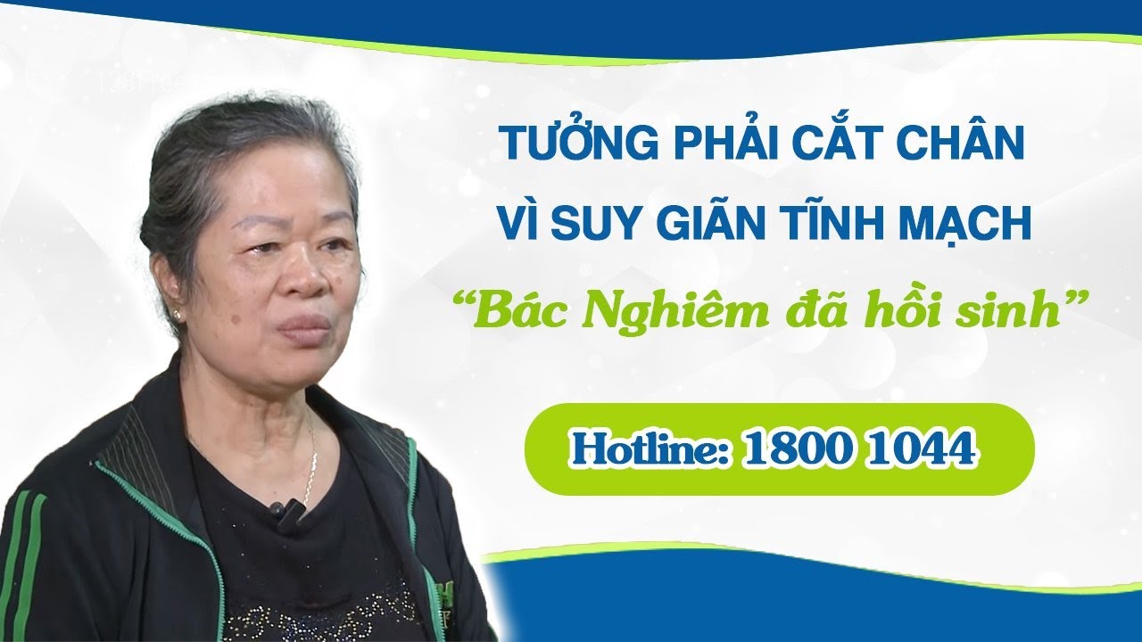 Tưởng phải cắt chân vì suy giãn tĩnh mạch